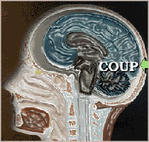 Coup