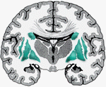 Basal ganglia